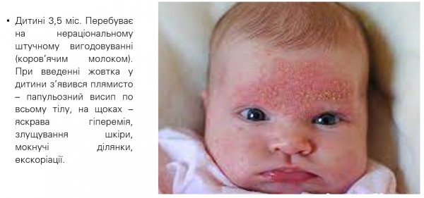 Book Page