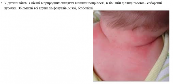 Book Page