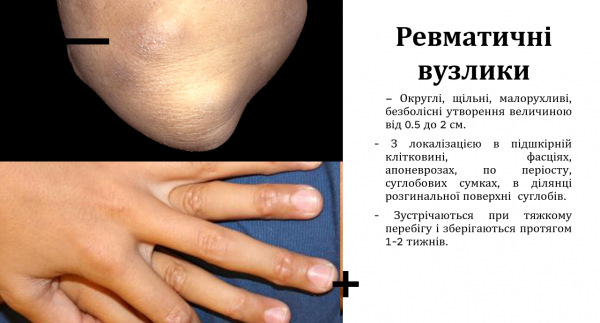Book Page