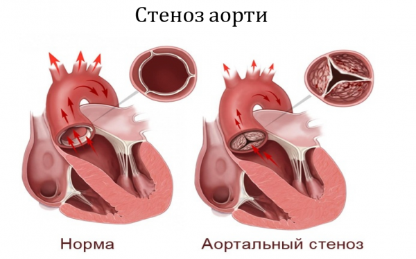 Book Page