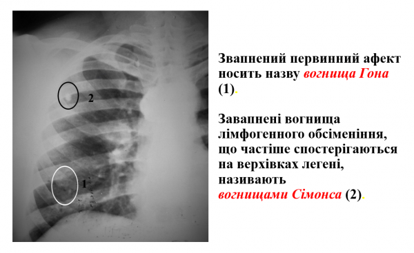 Book Page
