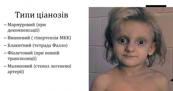 Book Page