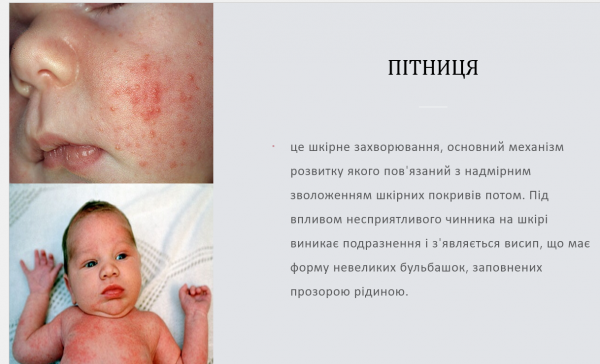 Book Page