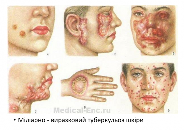 Book Page