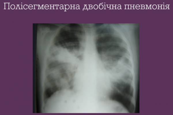 Book Page