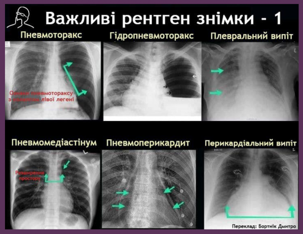 Book Page