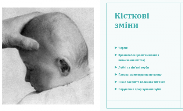 Book Page