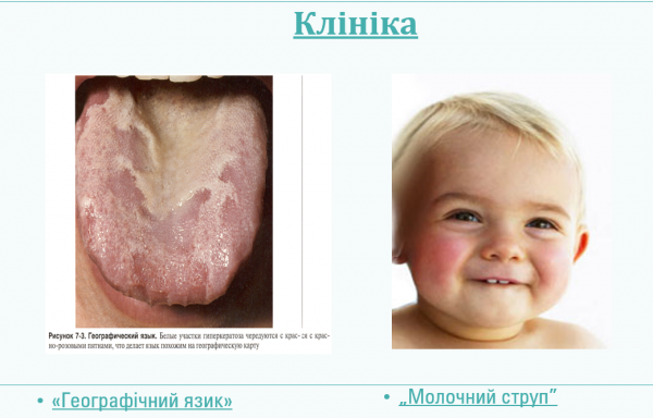 Book Page