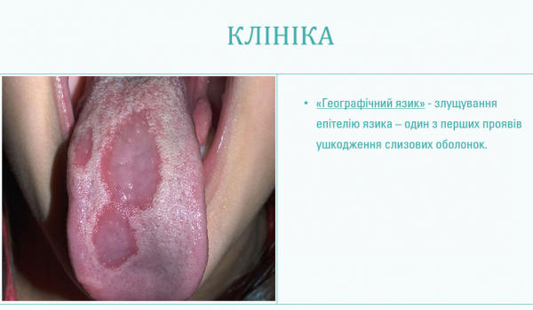 Book Page