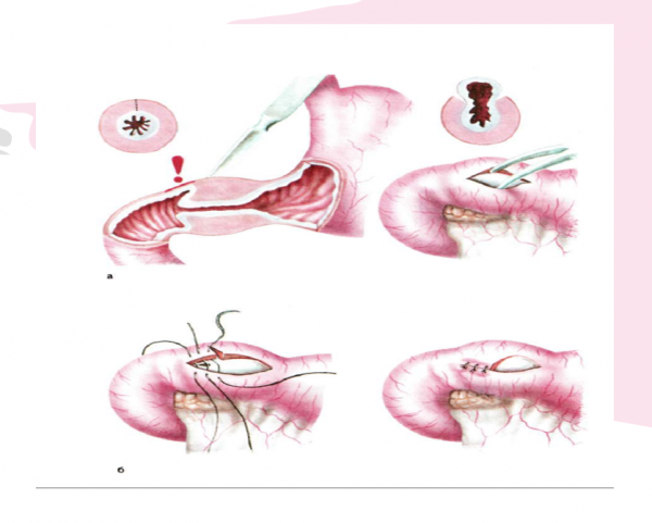 Book Page
