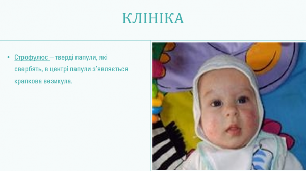 Book Page