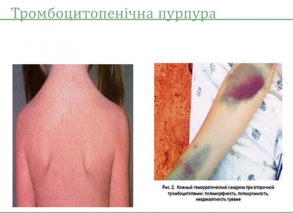 Book Page