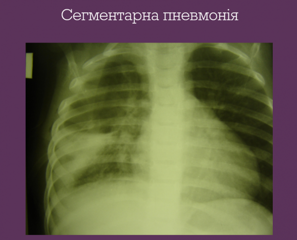 Book Page