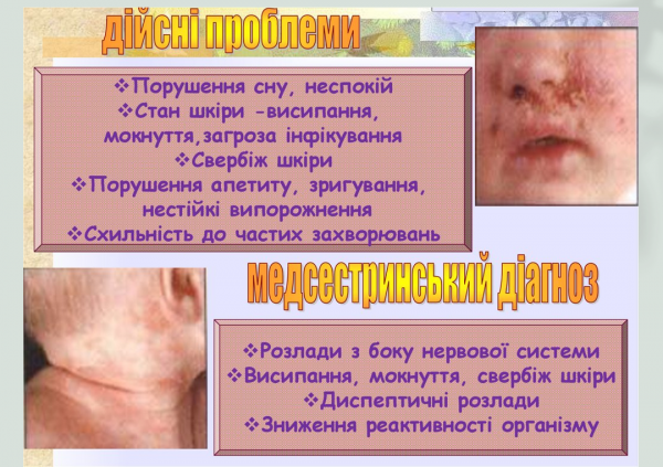 Book Page