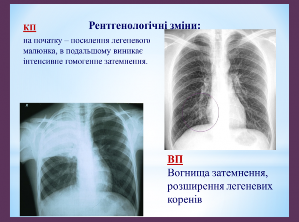 Book Page