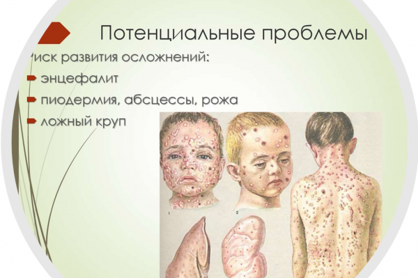 Book Page
