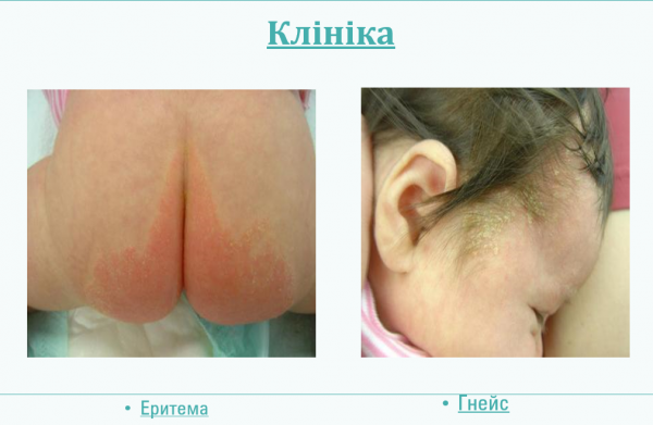 Book Page