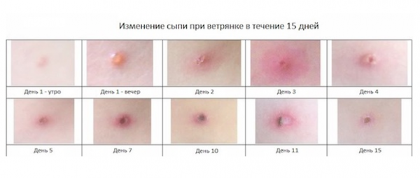 Book Page