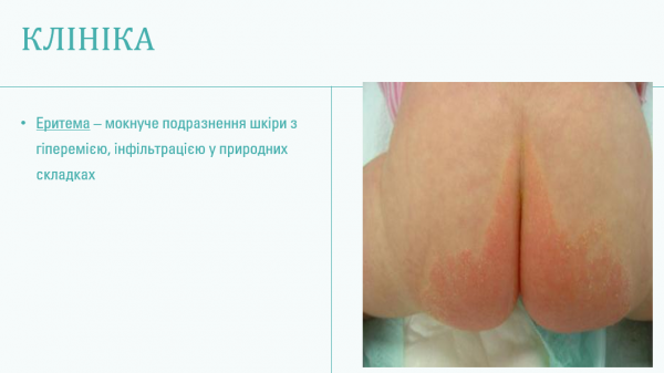 Book Page
