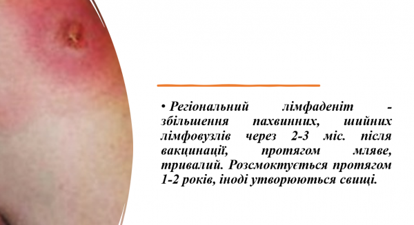 Book Page