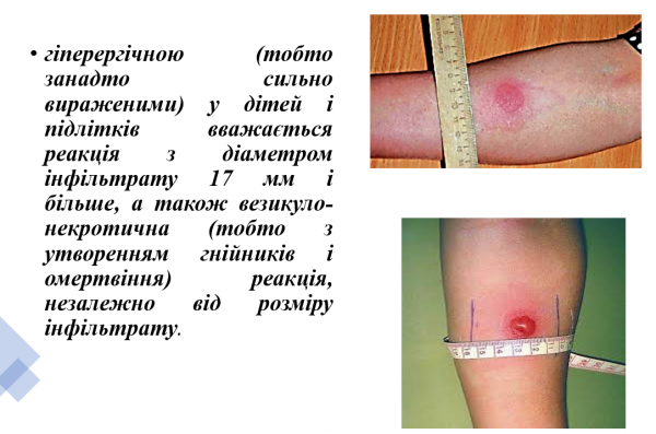 Book Page