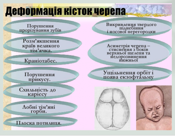 Book Page