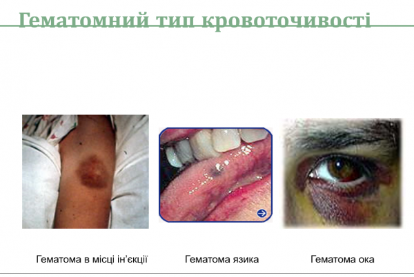 Book Page