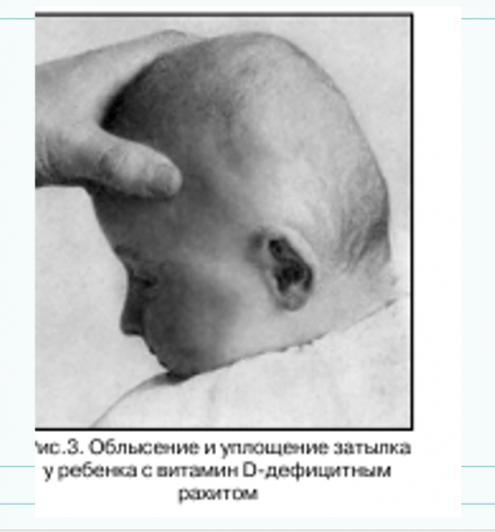 Book Page