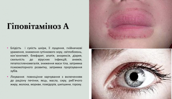 Book Page