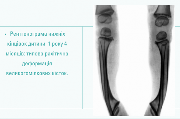 Book Page
