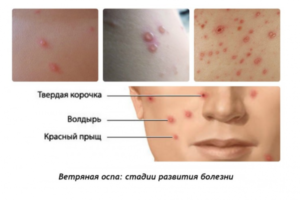 Book Page