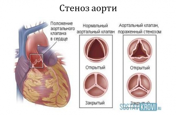 Book Page