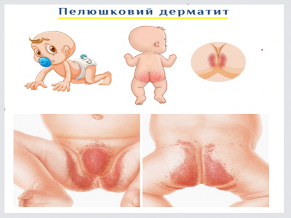 Book Page