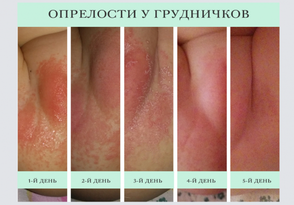 Book Page