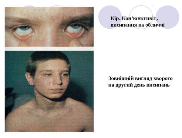 Book Page
