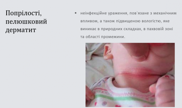 Book Page