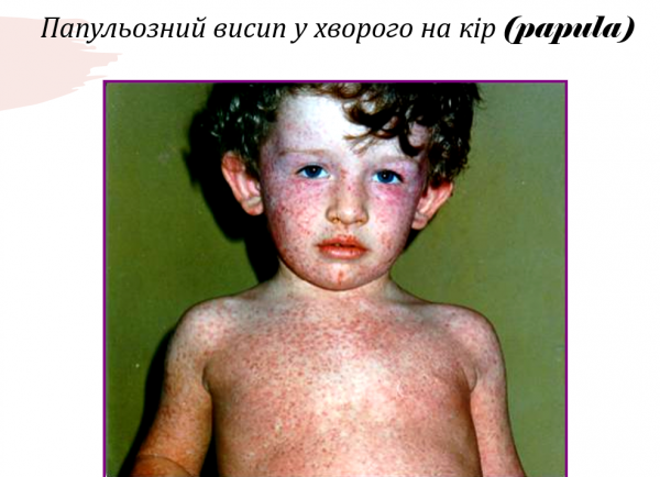 Book Page