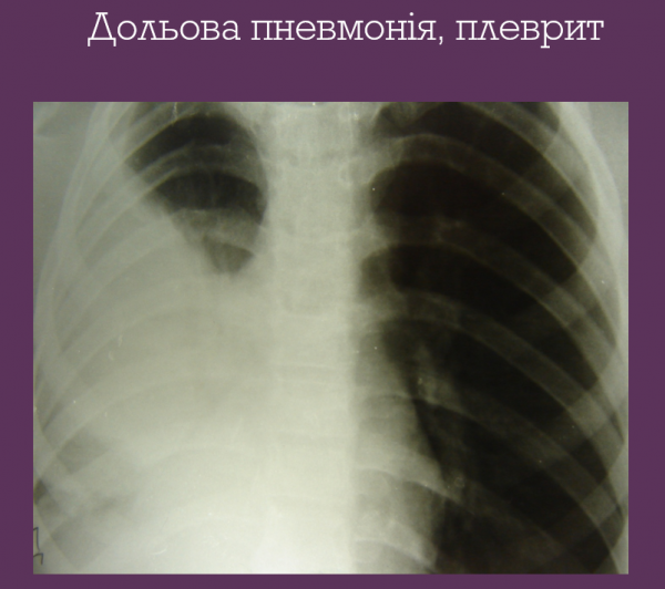 Book Page