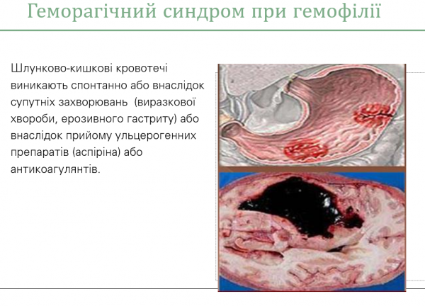 Book Page