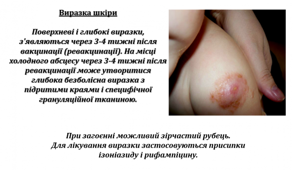 Book Page