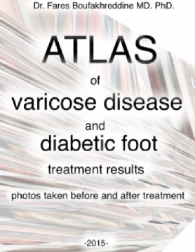 Atlas of varicose disease and diabetic foot treatment results