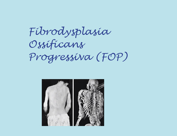 Fibrodysplasia Ossificans Progressiva