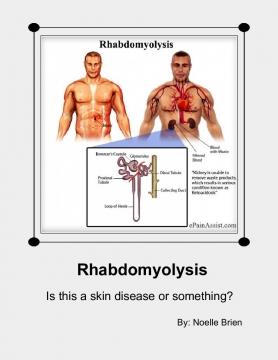 All About Rhabdomyolysis