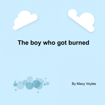 The boy who got burned