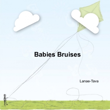 babies bruises