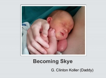 Becoming Skye