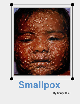 Smallpox-The Truth