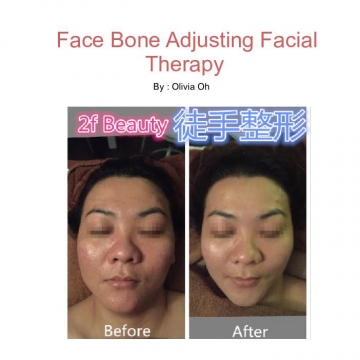 Bone Adjusting Facial Therapy