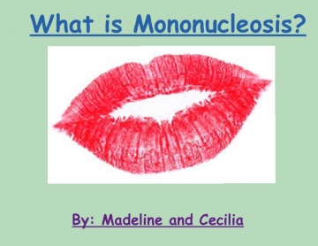 What is Mononucleosis?