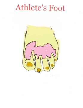 *
